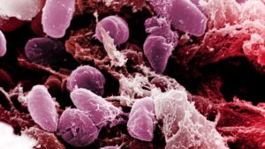 Cas mystérieux en Sibérie : peste ou pneumonie : comment le chercheur russe est-il mort ?